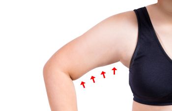 An arm of a woman in a black sleeveless top with four red arrows pointing arm lift plastic surgery area.