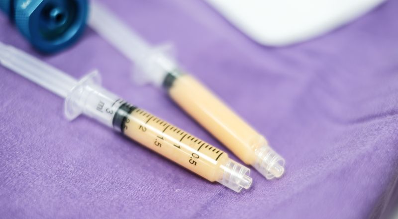Two syringes filled with adipose filler lie on a purple fabric surface, with one syringe partially filled and the other nearly full.